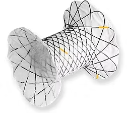 EUS-Guided Pancreatic Stents